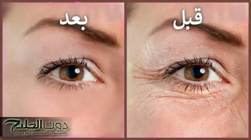289ddd2aba