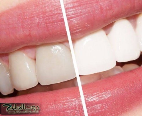 "سنانك هتبقي زي اللؤلؤة"...!! وصفات طبيعية مدهشة لـ تبييض الأسنان بمكونات منزلية اقتصادية!! 2 5f68c5c273