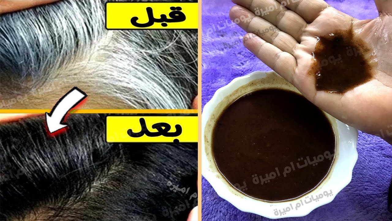 تخلصي من الشعر الابيض تدريجياً