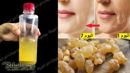 "اوعي تعيطى لو جوزك قالك ياعجوزه ".. وصفة لبان الدكر وزيت الزيتون الجبارة لتصغير وشد البشرة والتخلص من التجاعيد خلال 10 أيام فقط!!!! كنز ثمين !! 2 2a897079d0