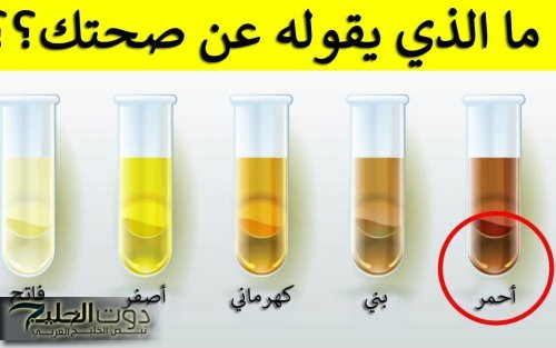 554bd4a85f